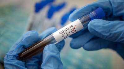 В России создали высокоточный тест для диагностики COVID-19