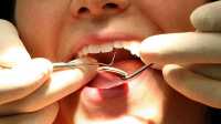 Врачей обвинили в смерти пациентки после удаления зуба
